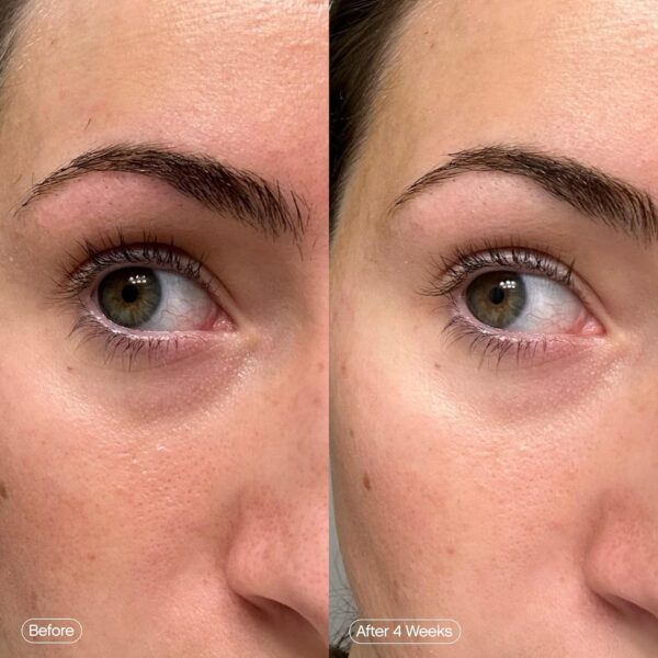 Topicals Faded Brightening Under Eye Masks 1pair - Image 5